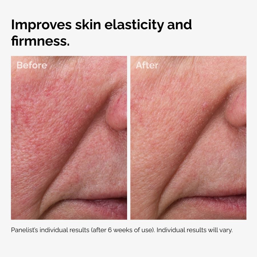 Rosehip Seed Facial Oil, 100% Fermented for Sensitive Skin