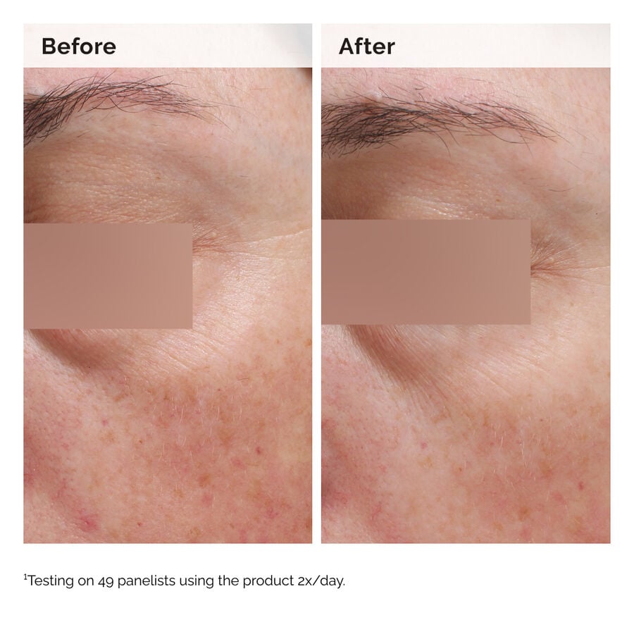 Niacinamide 5% Lightweight Lotion for Dark Spots on Face & Body