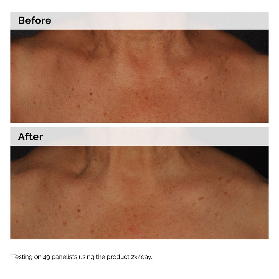 Niacinamide 5% Lightweight Lotion for Dark Spots on Face & Body