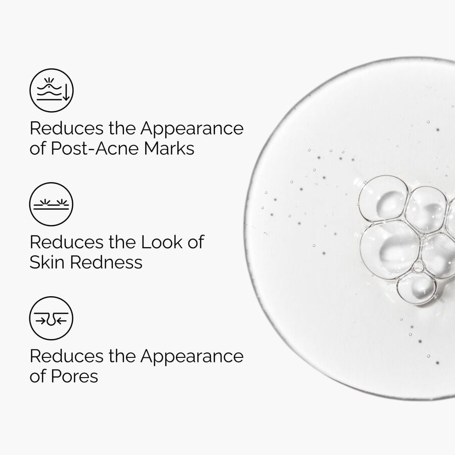 Post-Blemish Marks Serum, 2% Aloe and 2% N-Acetyl Glucosamine