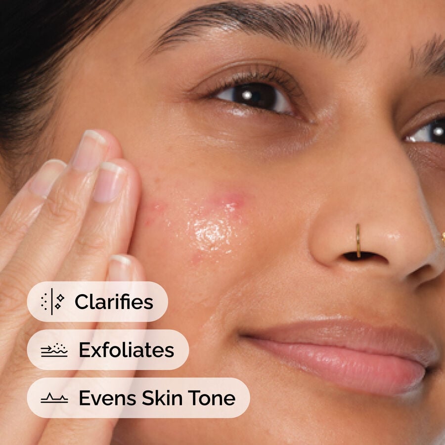 Water-Free Salicylic Acid 2% Pore-Clearing Exfoliating Treatment