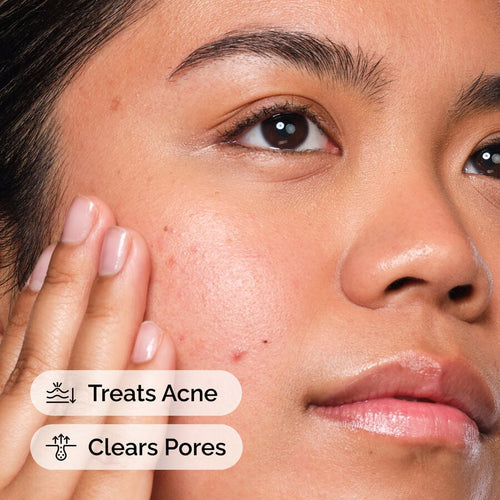 Blemish-Prone Skin BHA Exfoliating Treatment — Salicylic Acid 2%