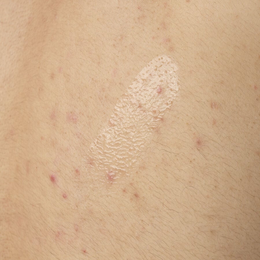 Smoothing Body Exfoliant for Bumps and Blemishes, 0.5% Salicylic Acid