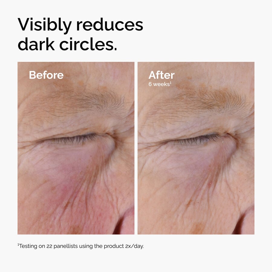 Tired Eye Brightening Treatment With Caffeine 5% + EGCG