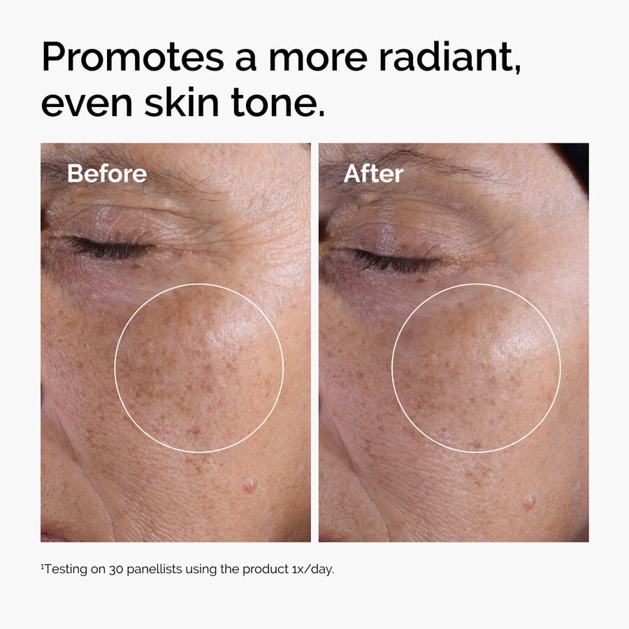 Glycolic Acid 7% Resurfacing Toning Solution for Smoother Skin