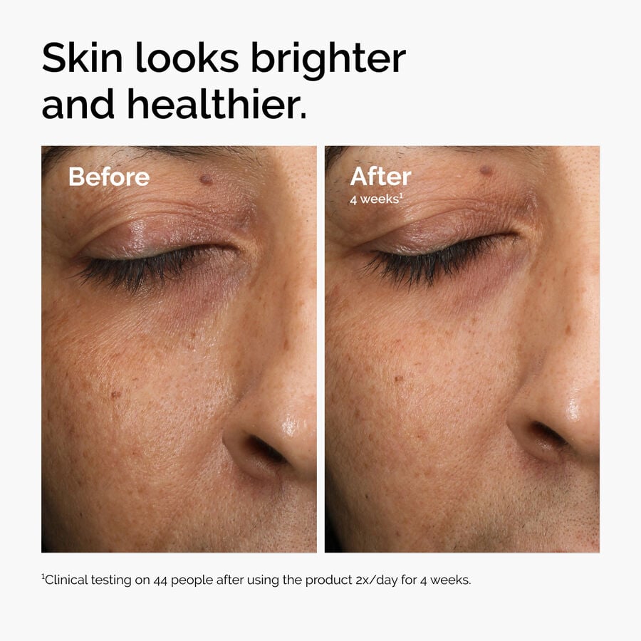 Daily Brightening Antioxidant Face Serum for Dull Skin