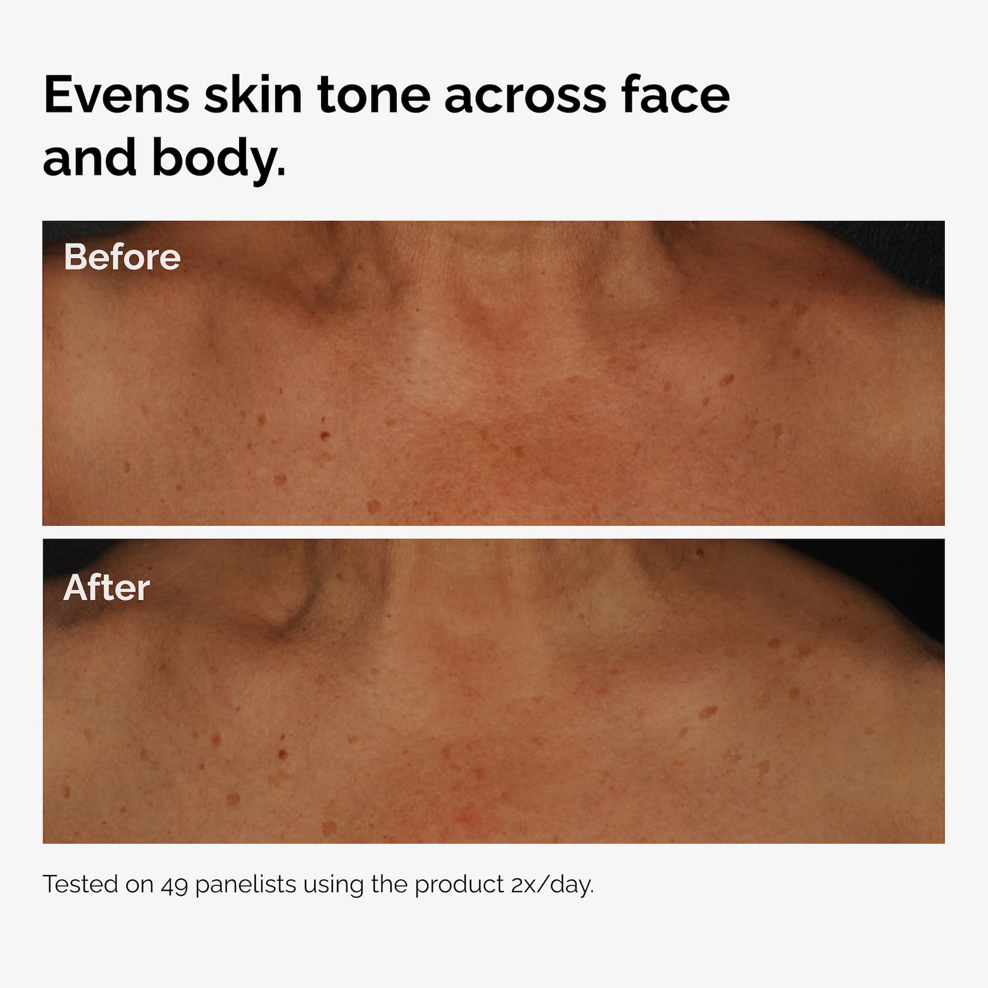 Niacinamide 5% Lightweight Lotion for Dark Spots on Face & Body