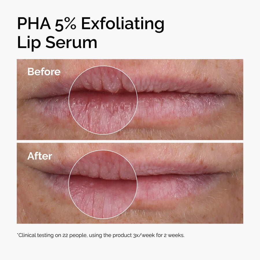 Smoothing Lip Treatment With 5% PHA (Gluconolactone)