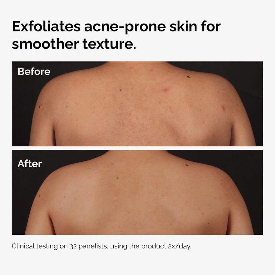 Full Body Skincare Routine Set — Serum, Emulsion & Lotion