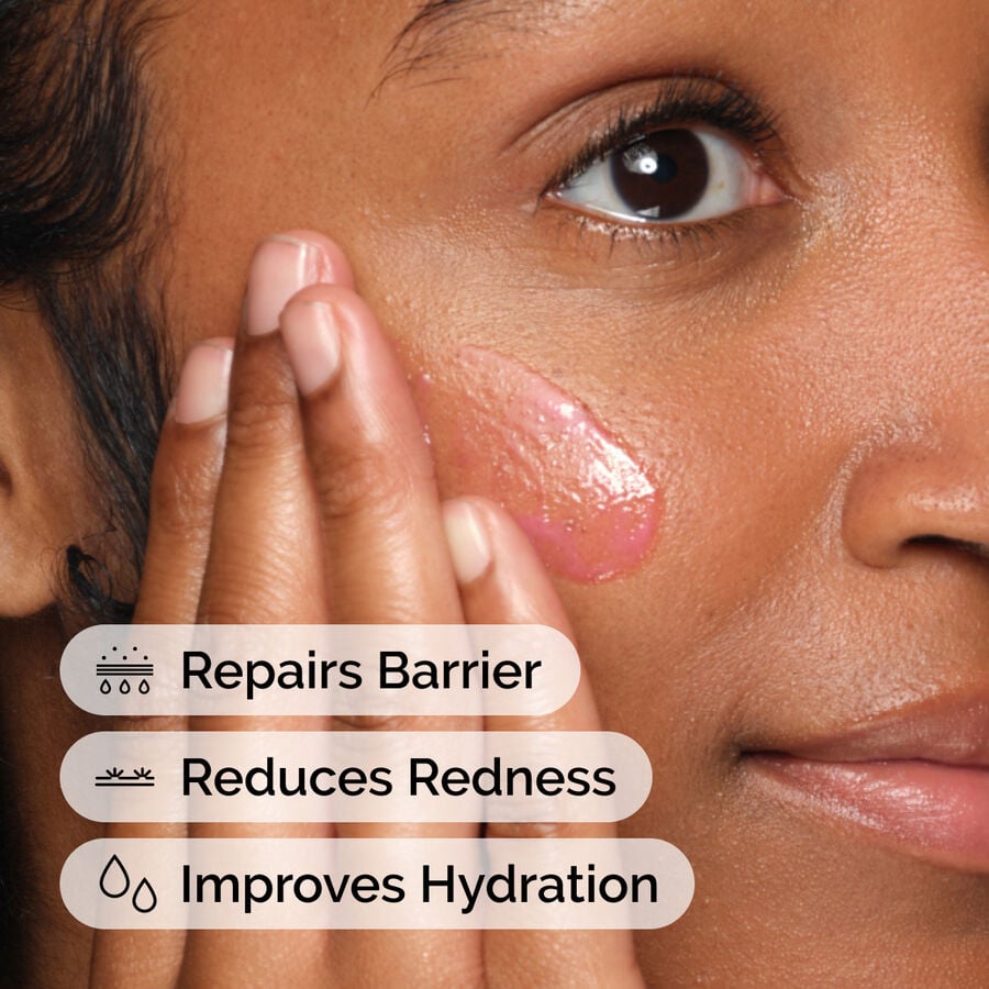 Barrier Support Emulsion for Redness-Prone, Sensitive Skin