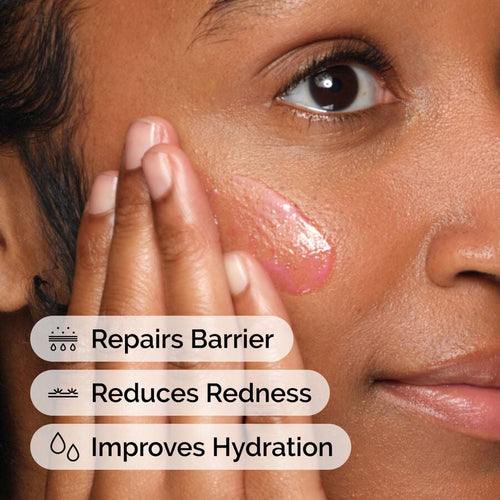 Barrier Support Emulsion for Redness-Prone, Sensitive Skin