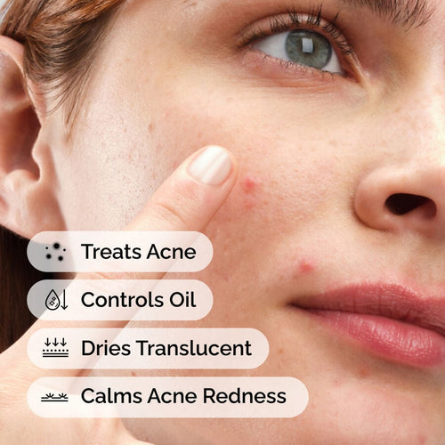 Blemish-Prone Skin Spot Formula — 10% Sulfur Powder-to-Cream