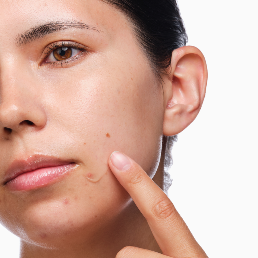 3-Step Blemish Routine Kit with Salicylic Acid 2% Solution